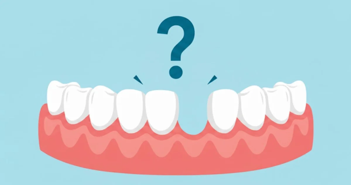 Congenitally Missing Teeth