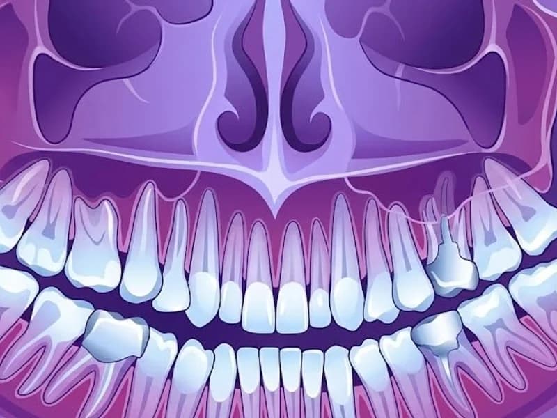Check-up X-Ray - Comprehensive oral examination and digital X-rays