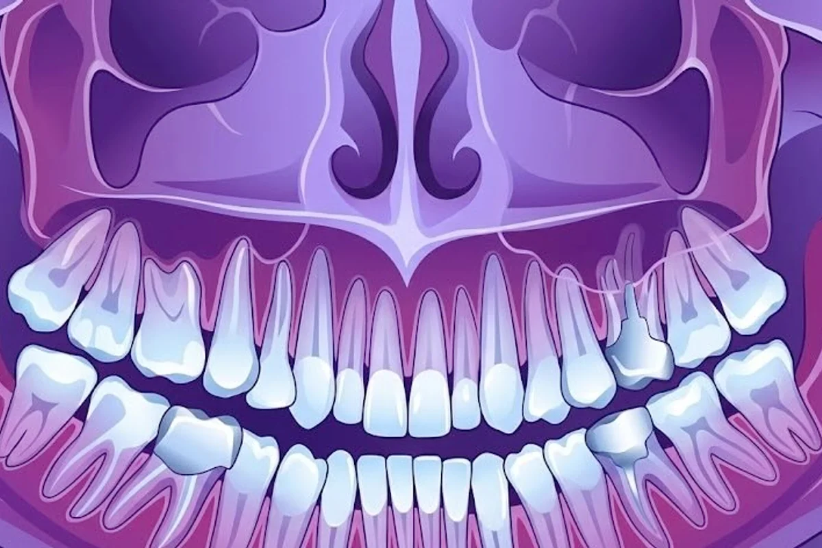 Check-up X-Ray - Comprehensive oral examination and digital X-rays